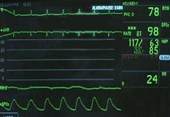 heart-monitor.jpg